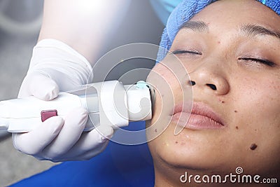 Treatment on Asian Woman as patient to make skin smooth bright Stock Photo