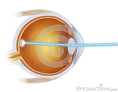 Treatment of macula Stock Photo