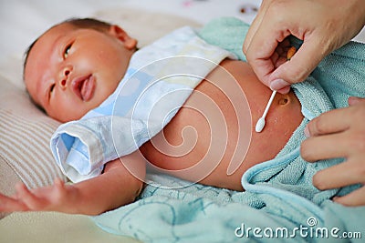 Treatment of newborn baby navel with a cotton swab Stock Photo