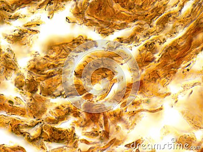 Treponema pallidum syphilis bacterium under microscope Stock Photo