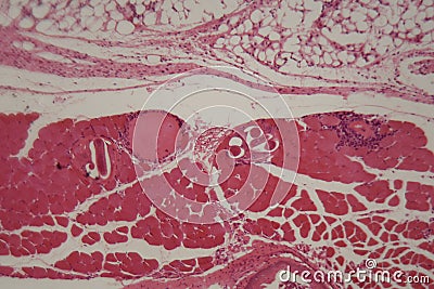 Trichinella spiralis larvae in muscle tissue under the microscope. Stock Photo