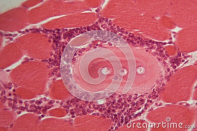 Trichinella spiralis larvae in muscle tissue under the microscope. Stock Photo