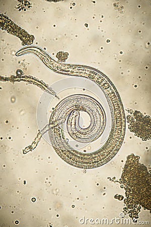 Trichinella spiralis - parasitic nematoda worm microscope Stock Photo