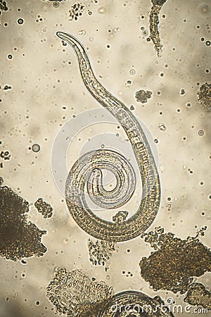 Trichinella spiralis - parasitic nematoda worm microscope Stock Photo