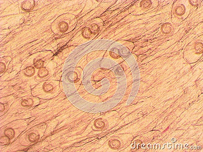 Trichinella spiralis - parasitic worm microscope Stock Photo