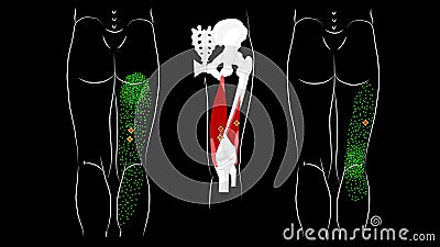 Trigger points and reflected pain in the hamstring muscles Stock Photo