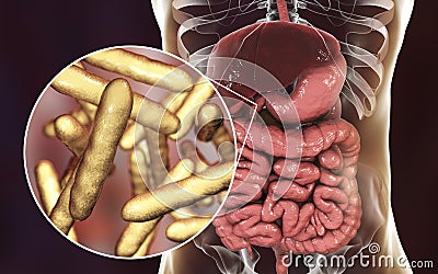 Tropheryma whipplei bacteria in human duodenum, the causative organism of Whipple& x27;s disease Stock Photo