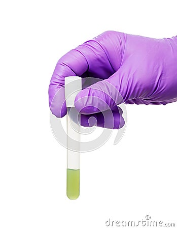 Tube with agar medium Stock Photo