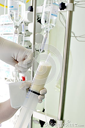 Tube feeding patient in the ICU Stock Photo
