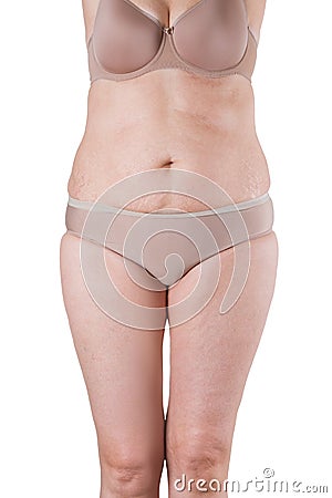 Tummy tuck, flabby skin on a fat belly, plastic surgery concept Stock Photo
