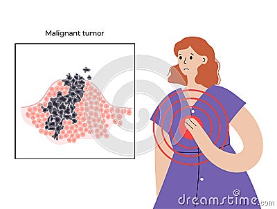 Tumor cells concept Vector Illustration