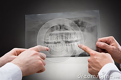 Two dentist holding dental xray Stock Photo