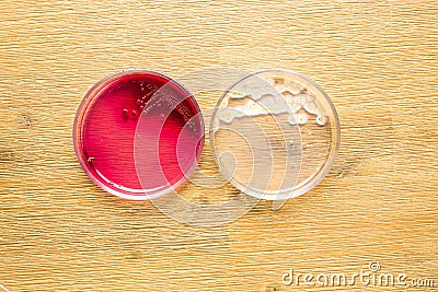Two Petri plates with growing bucterial cultures in medical laboratory Stock Photo