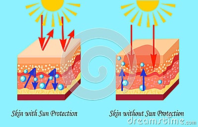 Two types of skin with and without sun protection, sunburn, vector illustration Vector Illustration
