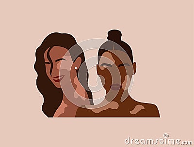 Two women with vitiligo of different nationalities together.Abstract faceless potrait of female. Pigmentation Vector Illustration