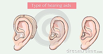 Type of hearing aids Vector Illustration