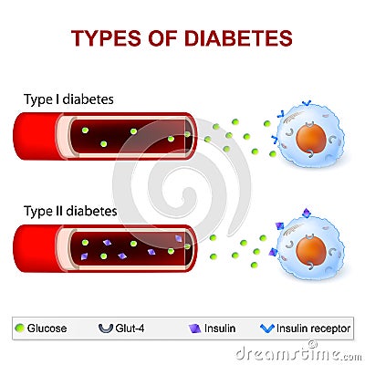 Types of Diabetes Vector Illustration