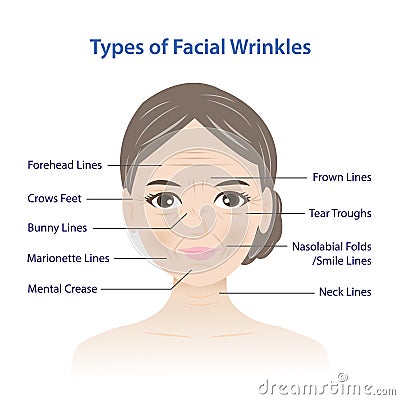 Types of facial wrinkles on woman face vector illustration isolated on white background. Cartoon Illustration