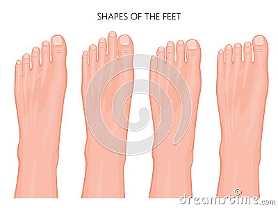 Types of the forefoot and toes Vector Illustration