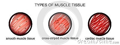 Types of muscle tissue Vector Illustration