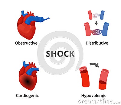 4 types of shock diagram. Medical emergency infographics Vector Illustration