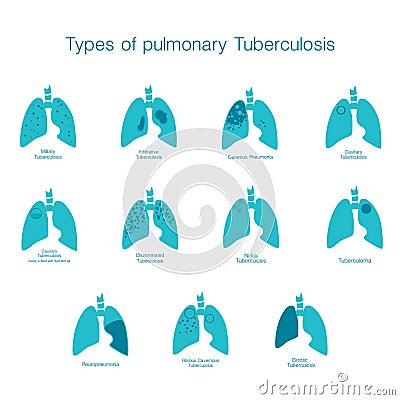 Types of tuberculosis. Vector silhouette medical illustration of human body organ Vector Illustration
