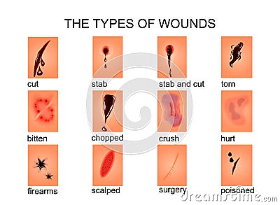 The types of wounds Vector Illustration