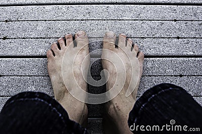 Ugly Feet Stock Photo