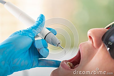 Ultrasonic teeth cleaning, close-up. Removal of tartar, plaque. Paradontitis, paradantoz. Dentistry, healthy teeth Stock Photo