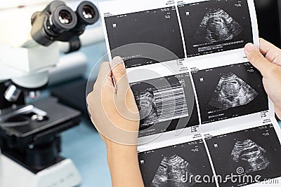 Ultrasound of baby in pregnant woman, Doctor reading test results of pregnant woman by ultrasound. Stock Photo