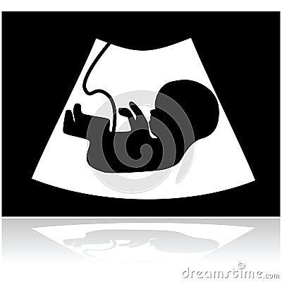 Ultrasound Cartoon Illustration