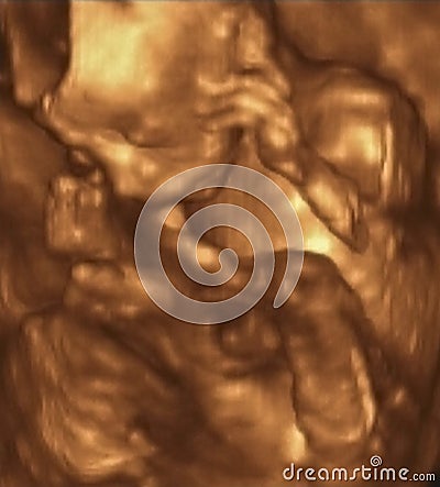 Ultrasound Echography of a 4th Month fetus, Italy Stock Photo