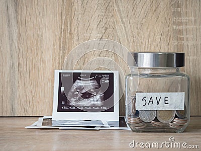 Ultrasound film of the child to be born Stock Photo