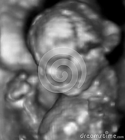 An ultrasound of a human fetus during the 16th week Stock Photo