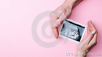 Ultrasound image pregnant baby photo. Woman hands holding ultrasound pregnancy picture on pink background. Pregnancy Stock Photo