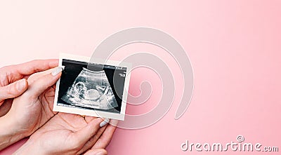 Ultrasound image pregnant baby photo. Woman hands holding ultrasound pregnancy picture on pink background. Pregnancy Stock Photo