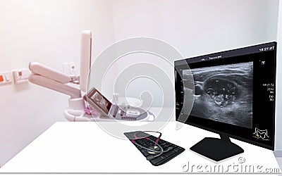 The ultrasound of the patient`s thyroid gland was reported on a monitor in the Treatment room hospital of thyrotoxicosis, and Stock Photo