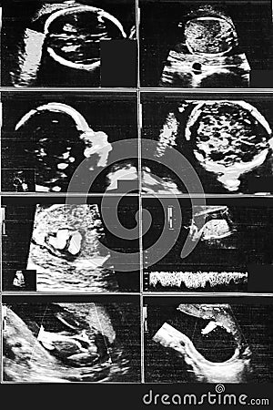 ultrasound picture baby memory photography Stock Photo