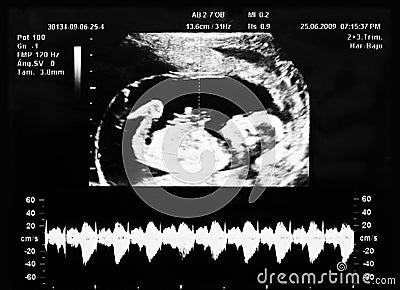 Ultrasound scan Stock Photo