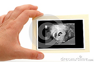 Ultrasound Scan for pregnancy Stock Photo