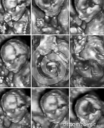 Ultrasound of a young fetus inside the womb. Collection of nine Stock Photo