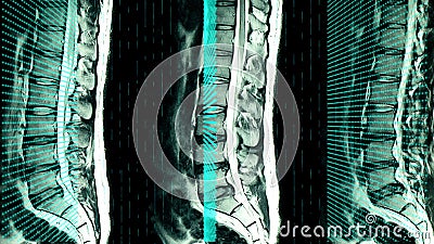 Un Scanner Mri De Lombaire Et Sacrum D Un Patient Banque De Videos Video Du Information Education