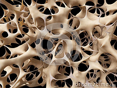 Unhealthy bone structure Stock Photo