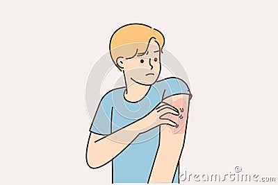 Unhealthy man scratching arm suffer from pox Vector Illustration