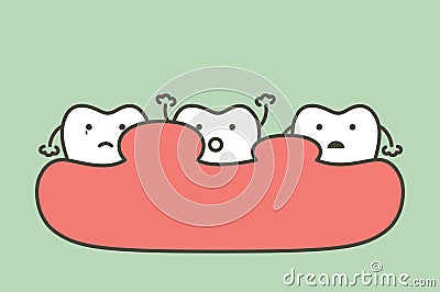 Unhealthy teeth because gingivitis or gum disease with abscess, gum is swollen Vector Illustration