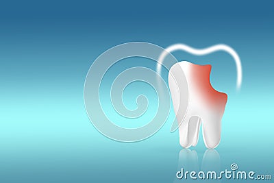 Unhealthy tooth white molar model and Protective vortex around tooth on pastel blue background. Tooth symbol sign. Caries. Caries Stock Photo