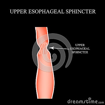 Upper sphincter of esophagus. Infographics. Vector illustration on black background. Vector Illustration