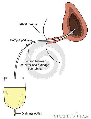 Urinary bladder collection bag Vector Illustration