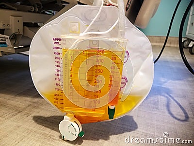 Foley catheter reservoir filled with yellow urine Stock Photo