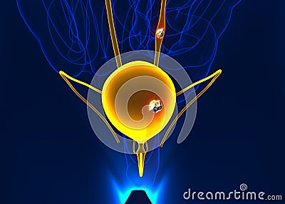 Urinary stones anatomy pain male internal organ painful cristaline mineral cross section - 3d illustration Cartoon Illustration